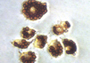 Phagocytosis Assays